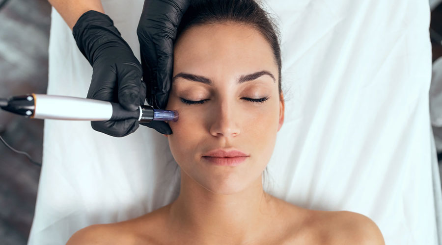 Dermapen Tedavisi