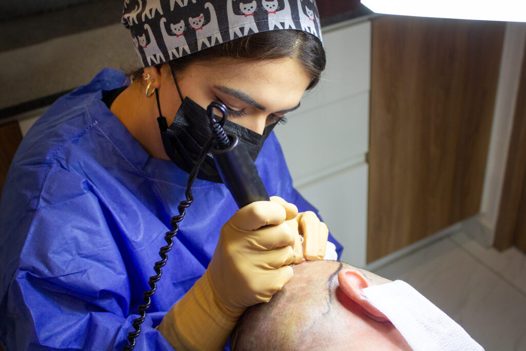 Kıbrıs Saç Ekimi | Cyprus Hair Transplant Center | Saç Ekim Merkezi. En Uygun ve Sağlıklı Kıbrıs Güzellik Merkezi. Kaş Ekimi ve Anti Aging. Bölgesel İncelme. Best Hair Transplant in Cyprus