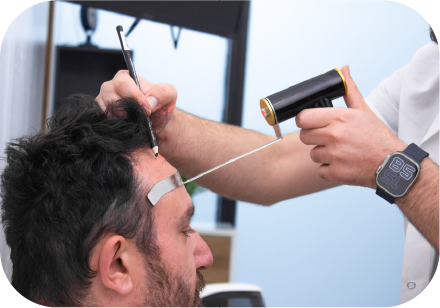 Kıbrıs Saç Ekimi | Cyprus Hair Transplant Center | Saç Ekim Merkezi. En Uygun ve Sağlıklı Kıbrıs Güzellik Merkezi. Kaş Ekimi ve Anti Aging. Bölgesel İncelme. Best Hair Transplant in Cyprus