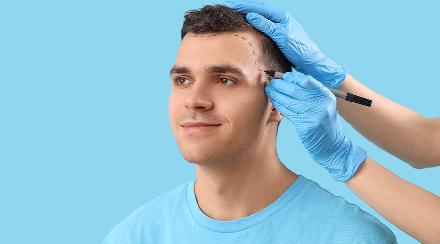 DHI vs FUE Hair Transplant: Which Method Is Right for You?